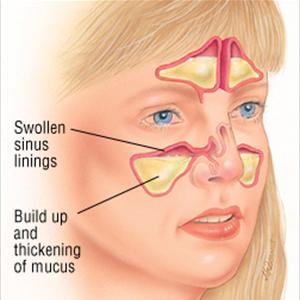 sinus pressure behind ear #10