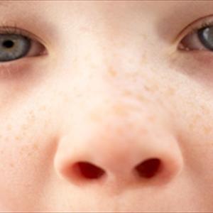 Smelling Burning In The Nose - Basic Information About Sinusitis Treatments