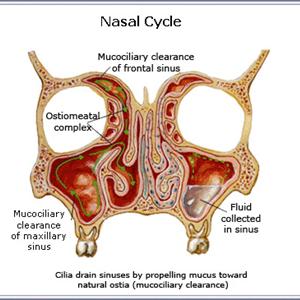 Is Sinol A Cure For Sinusitis 