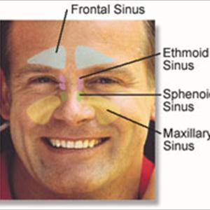 What Are Sinuses In Heart 
