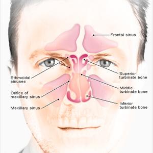  Sinusitis Treatments Meet And Also Greet