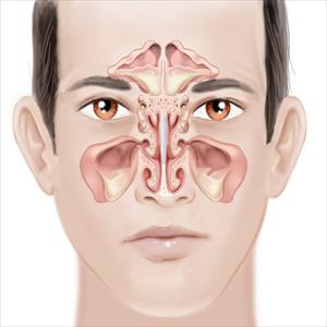  Some Sinusitis Natural Solutions