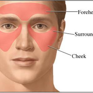Frontal Sinuses Affects On Eyes - Sinusitis Help: Home Remedies, Medications As Well As Doctor