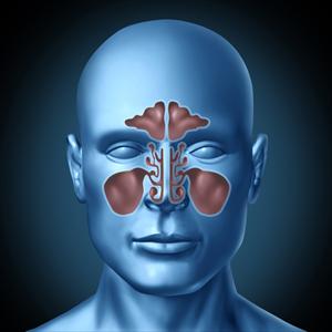 Finished Antibiotics Extreme Sinus Pain - Say Goodbye To Be Able To Microbial Sinusitis In 3 Easy Steps