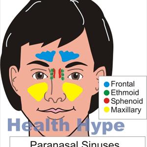  A Breakthrough Procedure For Longterm Sinusitis Sufferers