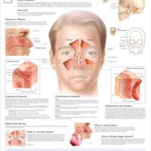Yellow Sinus Drainage And Colloidal Silver - Home Remedies For Sinusitis That Give Awesome Results